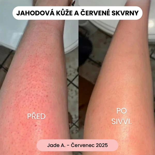 Jade A.