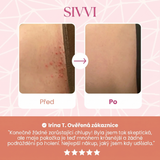 SIVVI® – Holicí strojek 2 v 1 pro citlivou pokožku